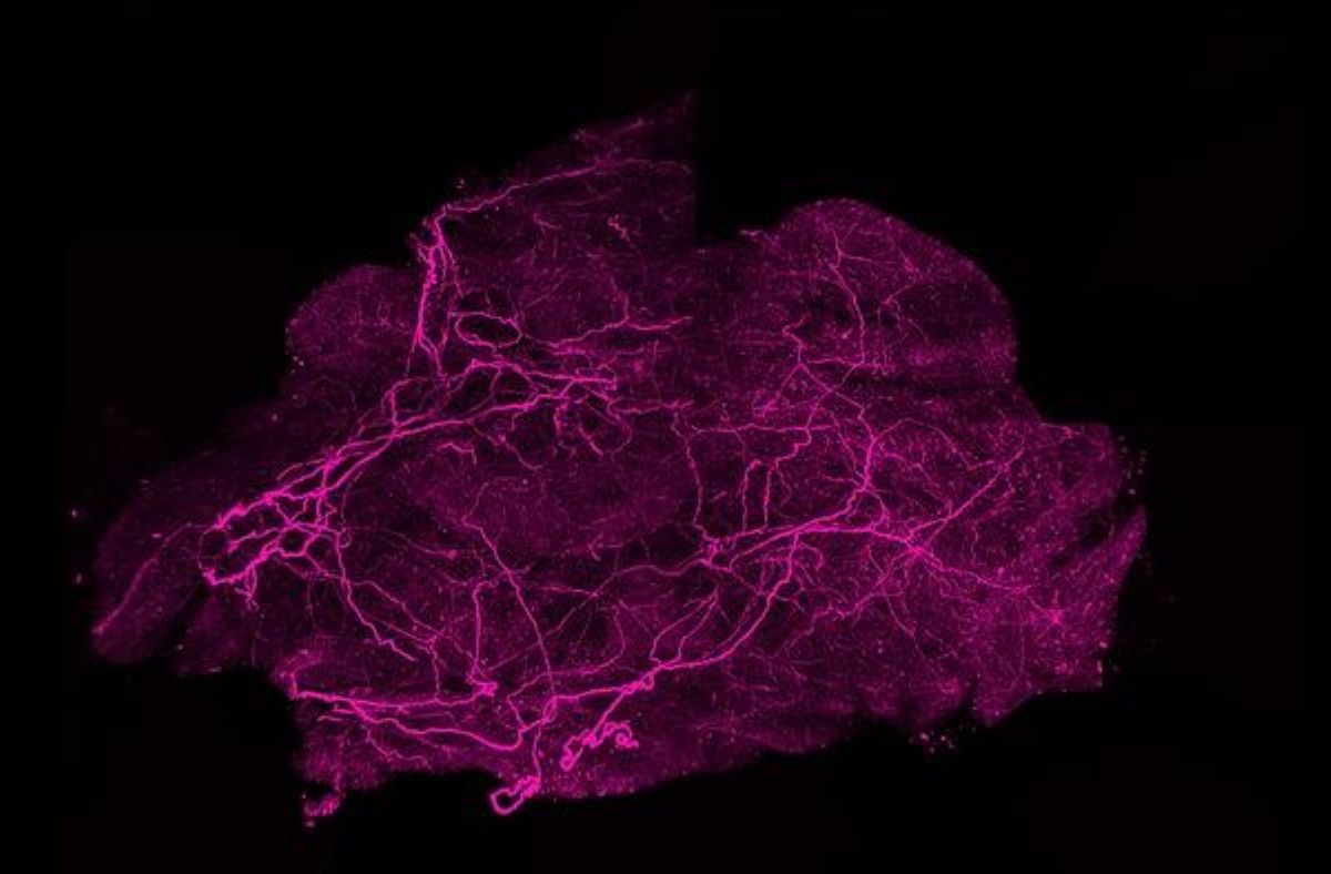 It shows brown fat under the microscope.